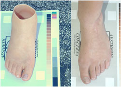 Cosmetic prosthesis