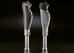 Knee Prosthesis